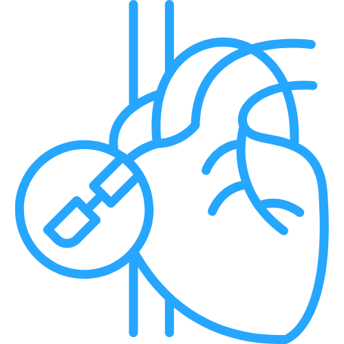 Bypass Surgery (CABG)